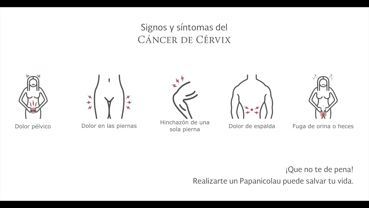 Javier Daniel Pérez Velázquez-8