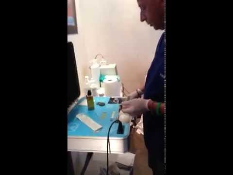 Una serie di esercizi dopo lintervento chirurgico per rimuovere unernia video intervertebrale Ernia intervertebrale lombare in pillole