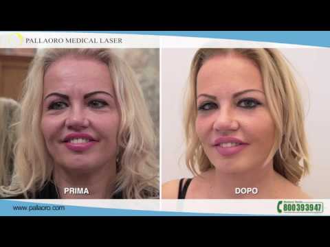 Da un pungiglione allocchio di bambino hypostasis Guardi imballano risposte 24k
