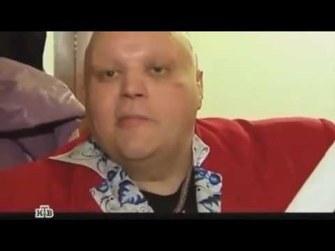 Стас Барецкий упал с лестницы