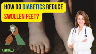 How Do Diabetics Reduce Swollen Feet?-The natural  way