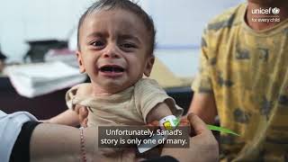 They need a Wira, Save Children Like Sanad