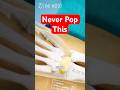 If You Pop a Ganglion Cyst:  What Happens 🟡
