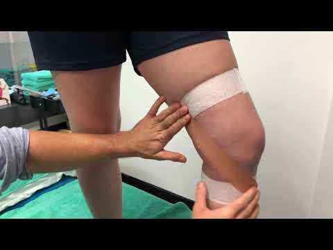 How to Strap the MCL (Medial Collateral Ligament Taping Technique)