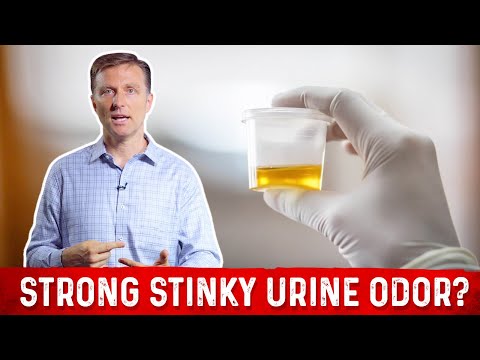 Pee Smells Bad? What Causes Strong Stinky Odor After Urination? – Dr. Berg