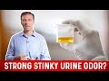 Pee Smells Bad? What Causes Strong Stinky Odor After Urination? – Dr. Berg