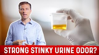 Pee Smells Bad? What Causes Strong Stinky Odor After Urination? – Dr.Berg