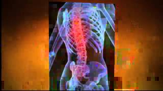 preview picture of video 'Chiropractic Pain Relief|Chiropractor Newmarket 07445149315|Chiropractors Newmarket|Arm and Leg Pain'