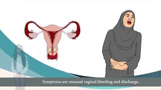 سرطان عنق الرحم cervical cancer