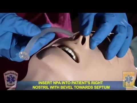 NYS EMT Skills (OPA/NPA/Suction)