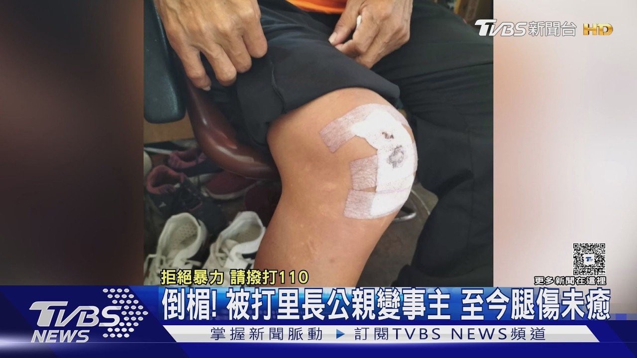 影音獨家/公親變事主! 倒楣被打里長3年多腿傷未癒 連任被迫中斷