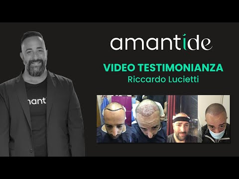 Video Amantide trapianto capelli Turchia