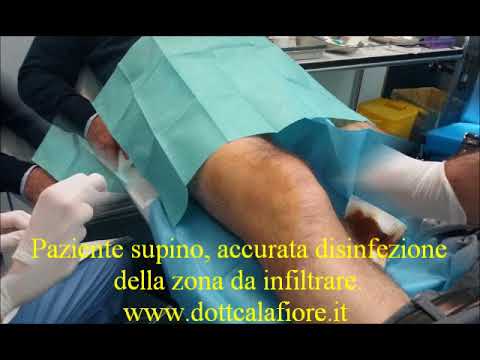 TEP Giunti medicina Meglio lubrificare le articolazioni