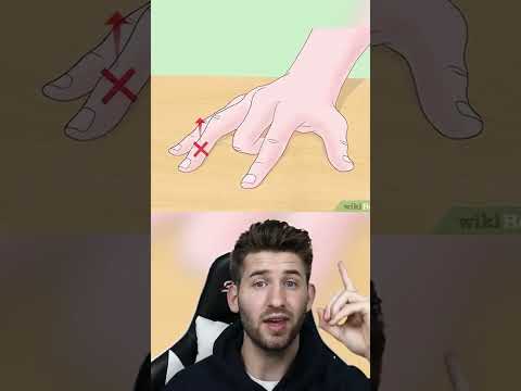 Paralyzed finger trick does it work? #shortsvideo