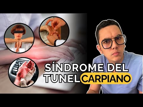 Señales de alerta de que tienes síndrome del túnel carpiano | Dr. William Guerrero
