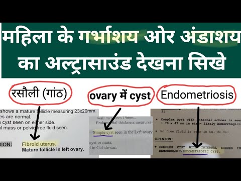 महिला के गर्भाशय (Uterus) ओर अंडाशय (ovary) का अल्ट्रासाउंड देखना सीखे