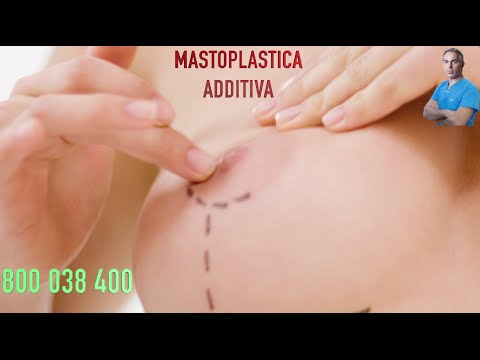 Ho presentato un divertente ragazza i Composta è utile per la potenza