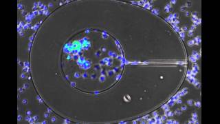 neutrophil vs. staph :  staph wins