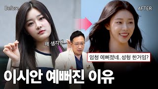 솔로지옥 이시안 윤곽수술 성공 비결은?✨ 무조건 많이 깎는다고 좋은 게 아닙니다