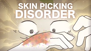 Skin Picking Disorder .. What is it?