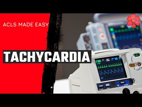 ACLS Tachycardia Algorithm