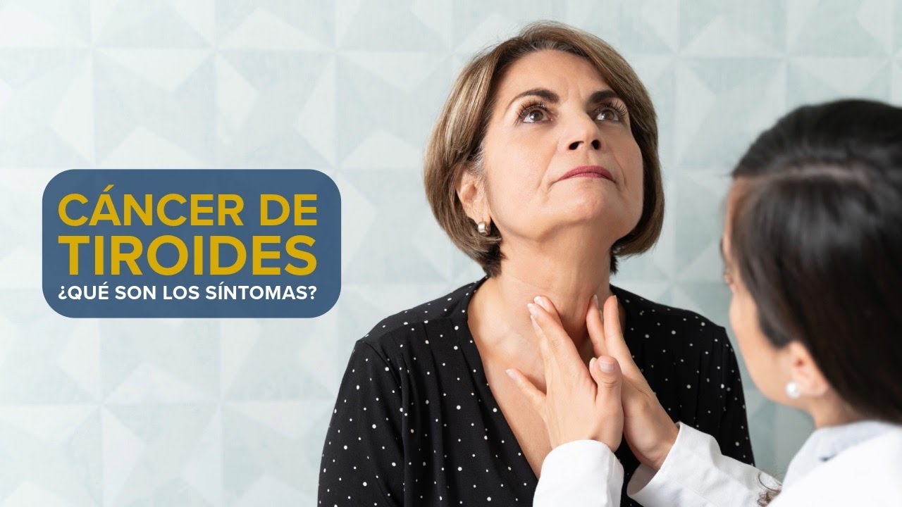 Thumbnail preview of Cáncer de tiroides - ¿Cuáles son los síntomas?