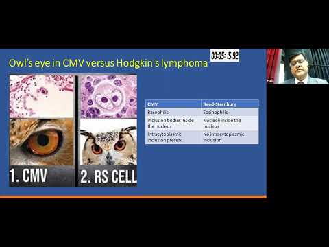Non Hepatotropic Viruses as a Cause for Acute Viral Hepatitis, Prof  Amit Goel, Hepatology
