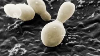  Penetration Layer Deep into Hair Bulb