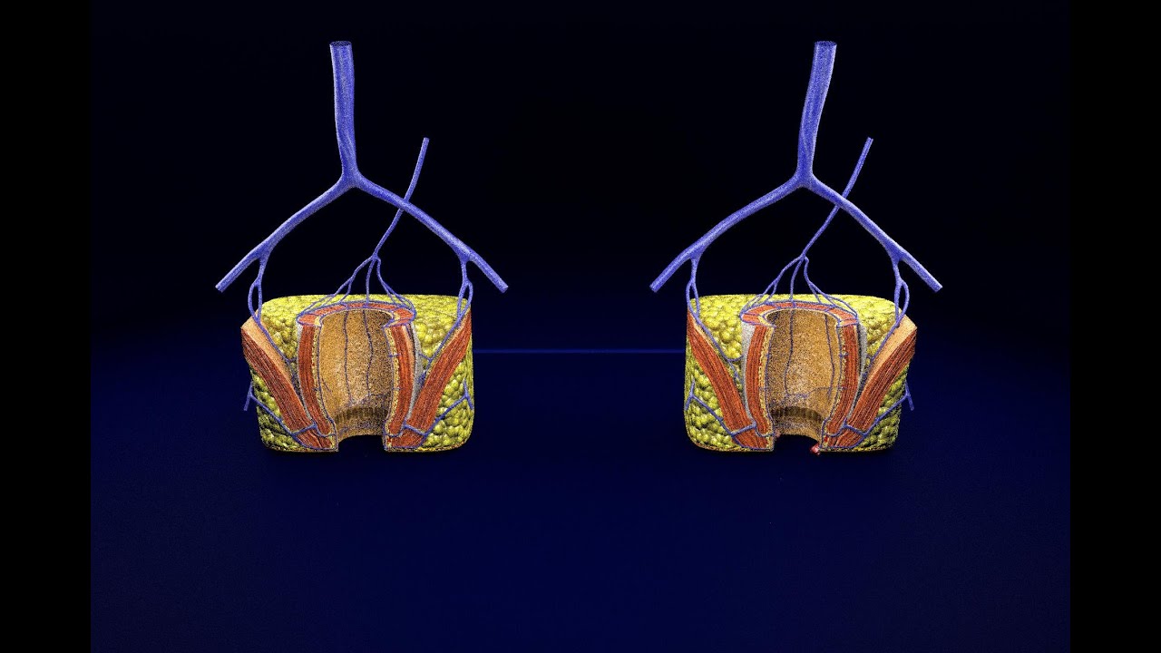 3D hemorrhoids CLEANED UP model 3D Model