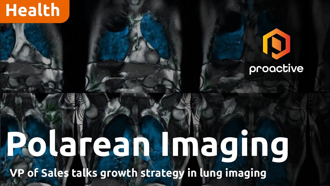 Polarean Imaging: new VP's growth strategy for functional lung imaging