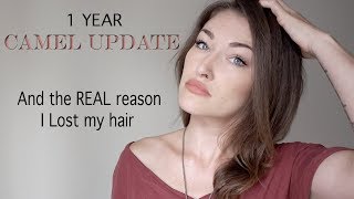 1 year Camel Urine update and the real reason my hair fell out- Story time !