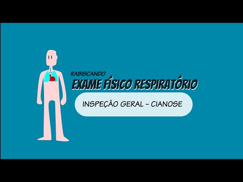 Inspeção geral - Cianose - Exame Físico Respiratório