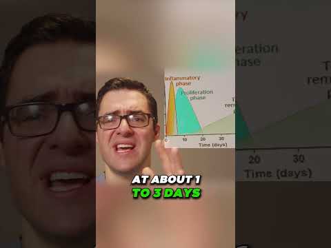 Why Is My Sprained Ankle Still Swollen After 3 6 or 12 MONTHS