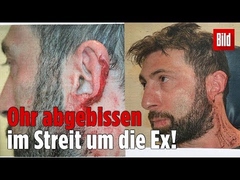 Alles wegen der Ex! Irrer Ohr-ab-Prozess von Recklinghausen