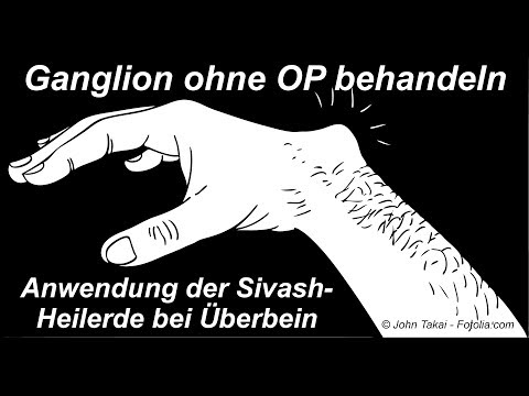 Drückender Schmerz in der rechten Seite von der Rückseite unten Eitriger Bursitis des Knies ICD 10
