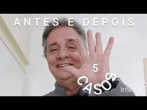 Marcelo Emanoel-47