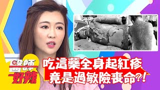 吃「這藥」全身起紅疹，竟是過敏險喪命？！【#醫師好辣】20210517 part2 EP1150 宋明樺 洪素卿