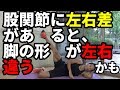 股関節に左右差があると、脚の形が違うかも?アブダクションロールで股関節を調整する