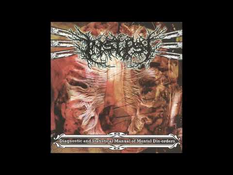 Insepsy - Idiopathic Thrombocytopenic Purpura