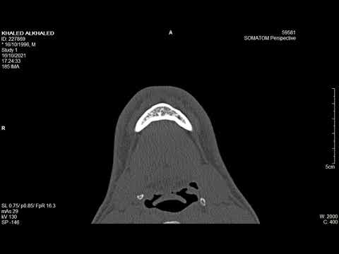 KHALED ALKHALED Dental  0 75  H70s #5