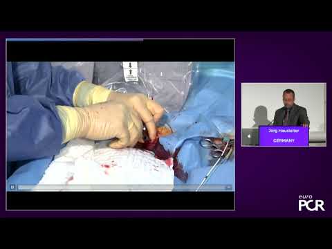 TRIC VALVE Live case PCR 2022