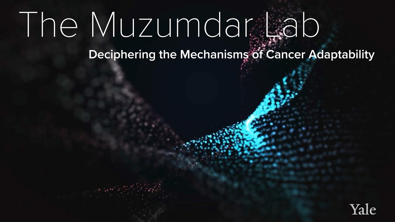 Cancer Progression, Genetics & Environmental Influence - The Muzumdar Lab at Yale School of Medicine