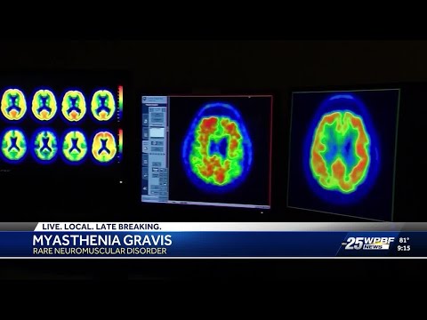 What is Myasthenia Gravis?