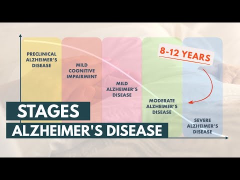 Stages and Life Expectancy of Alzheimer's Disease