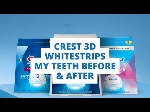 My Review & Test of Crest 3D Whitestrips Professional Effects Teeth Whitening Strip Kit