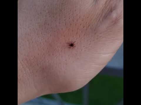 Iksodinė erkė. Erkių naikinimas.