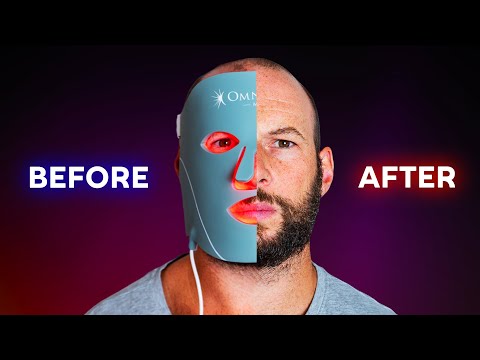 I Tried The Omnilux Mask For 5 Weeks: Surprise?