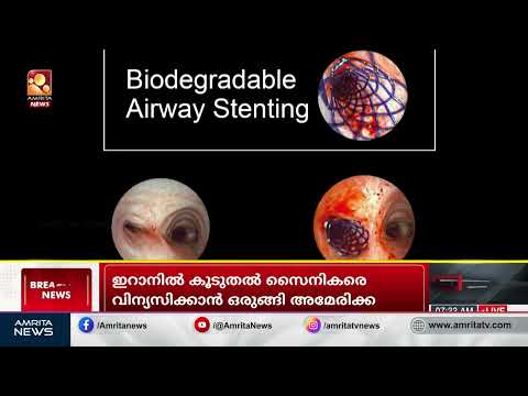 Pulmonologist in kochi