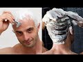 डैंड्रफ की समस्या Scalpe Plus ShampooReview Dandruff Treatment Anti Da