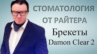Брекеты Damon clear 2: стоимость, установка и отзывы.
